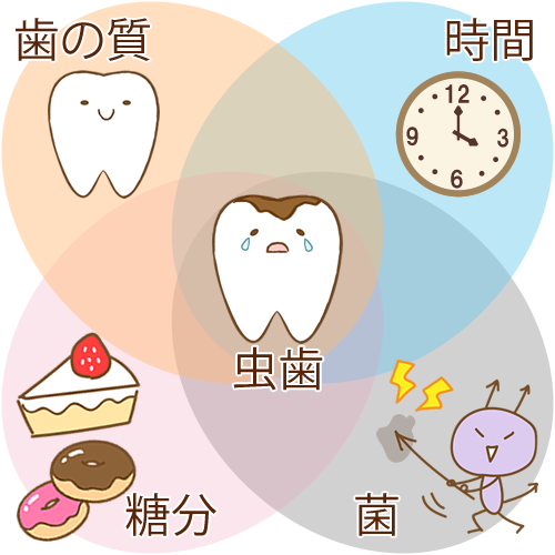 むし歯の原因 リスクファクター図